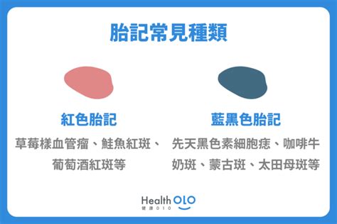 為什麼會有胎記|胎記怎麼產生、何時消除？醫師剖析胎記種類、胎記寓意